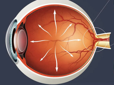 Circle P Glaucoma 01